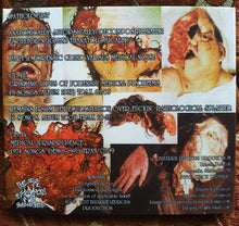 Pathologist: Anatomically! Autopsically! Decompositionally! Eschatologically! Thanatologically! (Part II: Forensic Grind Versus Medical Noise) 2xCD