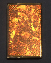 Schistosomiasis: Excretion Of Sporocysts In Parasitic Worm Vomitus cassette