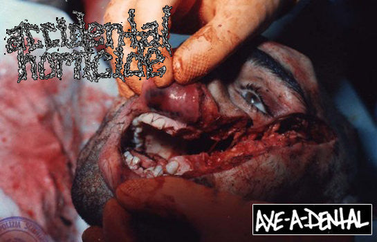 Accidental Homicide: Axe-A-Dental cassette