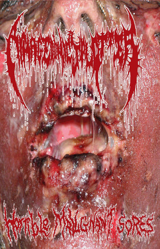 Armagedonic Splatter: Horrible Malignant Sores cassette