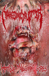 Armagedonic Splatter: Horrible Malignant Sores cassette