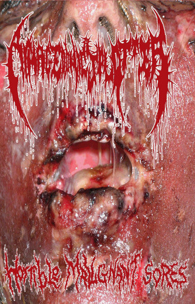 Armagedonic Splatter: Horrible Malignant Sores cassette
