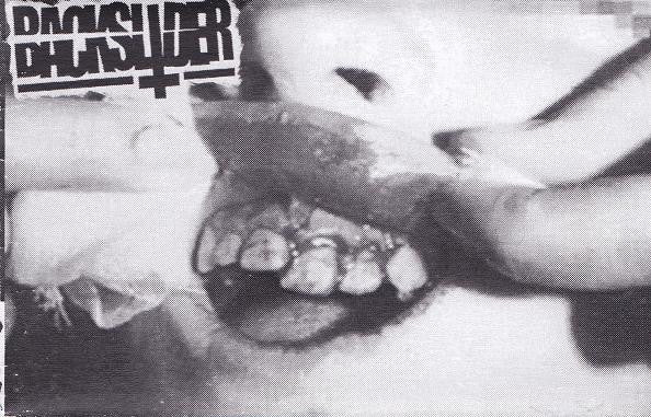 Backslider: Skullfracturing Fastcore cassette