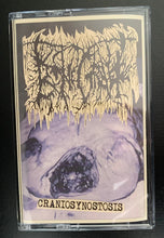 Bonegraft: Craniosynostosis cassette