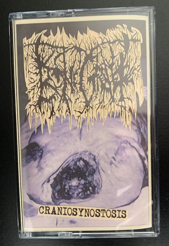 Bonegraft: Craniosynostosis cassette
