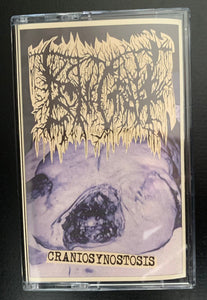 Bonegraft: Craniosynostosis cassette