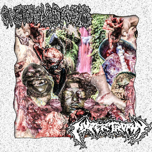 Cystoblastosis / Hypertrophy: Split cassette