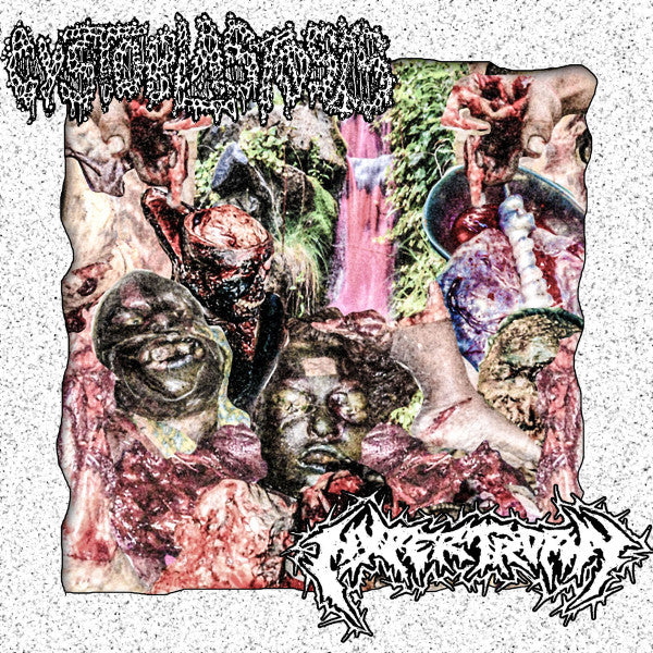 Cystoblastosis / Hypertrophy: Split cassette