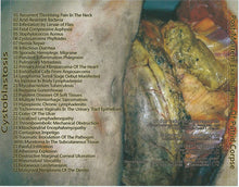 Cystoblastosis: Post-Mortem Examination Of Putrid Corpse CD