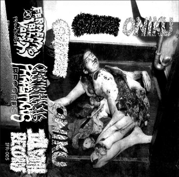 Gastroptosis / Oniku: Split cassette