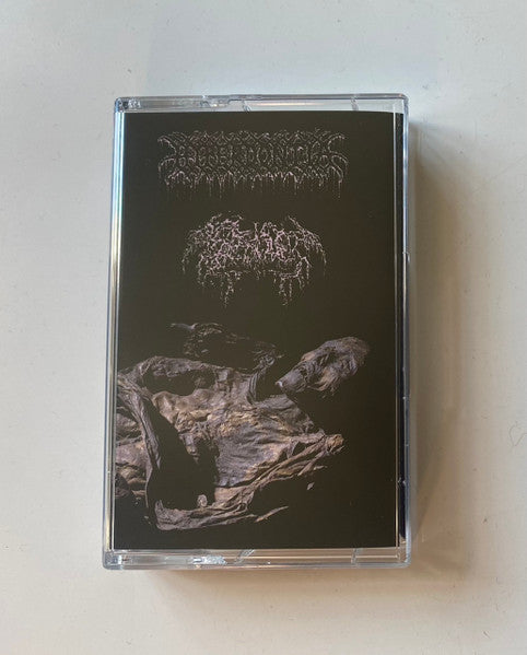 Hyperdontia / Septage: split cassette
