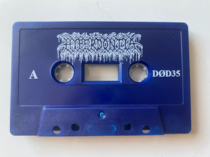 Hyperdontia / Septage: split cassette