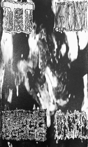 Intestine / Myxorrhea / Malevolent Scrotal Incendiary / Gangrenous Stomatitis Necrosis: Split cassette