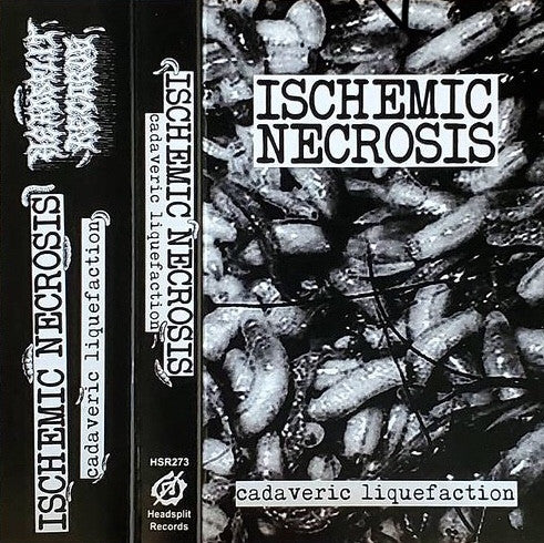 Ischemic Necrosis: Cadaveric Liquefaction cassette