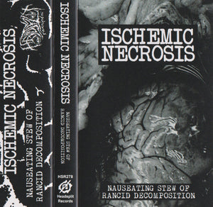 Ischemic Necrosis: Nauseating Stew Of Rancid Decomposition cassette