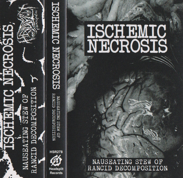 Ischemic Necrosis: Nauseating Stew Of Rancid Decomposition cassette