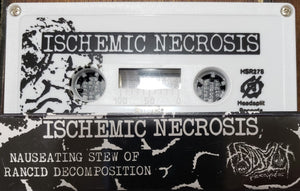 Ischemic Necrosis: Nauseating Stew Of Rancid Decomposition cassette