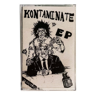 Kontaminate: S/T cassette