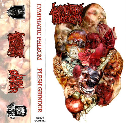 Lymphatic Phlegm / Flesh Grinder: Malignant Cancerous Tumour In The Epithelial Tissue Of The Intestine / From Rotten Process... To Anatomy cassette