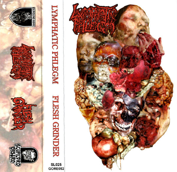 Lymphatic Phlegm / Flesh Grinder: Malignant Cancerous Tumour In The Epithelial Tissue Of The Intestine / From Rotten Process... To Anatomy cassette