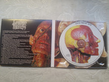 Lymphatic Phlegm: Show-Off Cadavers - The Anatomy Of Self Display CD