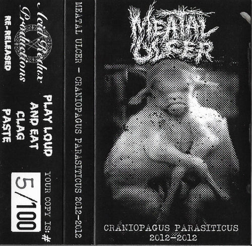 Meatal Ulcer: Craniopagus Parasiticus cassette