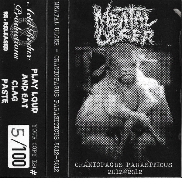 Meatal Ulcer: Craniopagus Parasiticus cassette