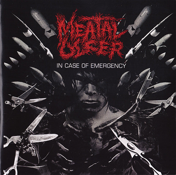Meatal Ulcer: In Case Of Emergency 7