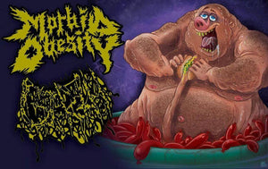 Morbid Obesity / Girth: Split cassette