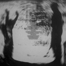 Neuroot / No Pigs / Stanx: Split 12"