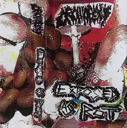 Orchiopexy / Exposed As Rot: Split cassette