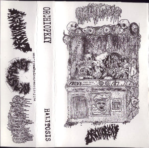 Orchiopexy / Halitosis: Split cassette