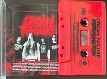 Organ Failure: Assisted Anatomical Butchery cassette