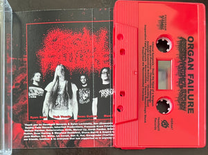 Organ Failure: Assisted Anatomical Butchery cassette