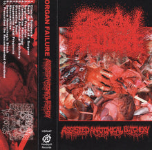 Organ Failure: Assisted Anatomical Butchery cassette