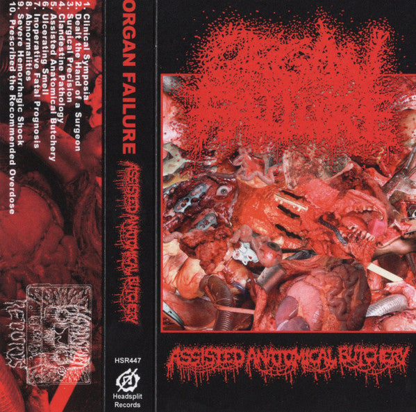Organ Failure: Assisted Anatomical Butchery cassette