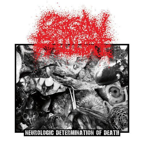 Organ Failure: Neurologic Determination Of Death CD