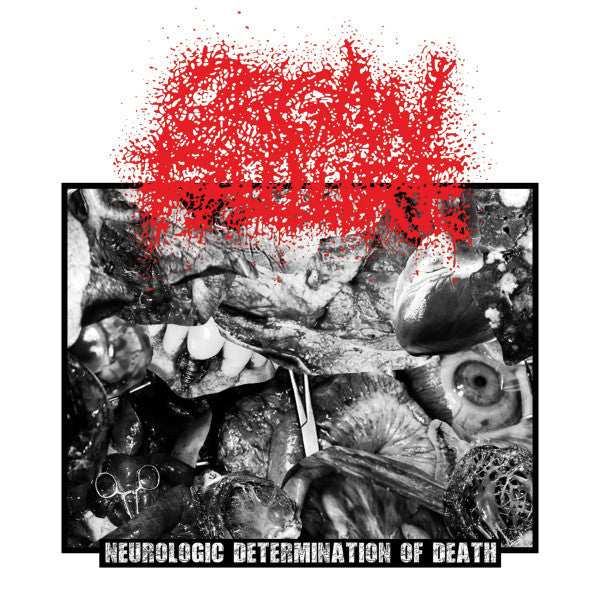 Organ Failure: Neurologic Determination Of Death CD