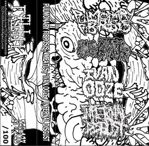 Pulmonary Fibrosis / Meatus / Ivan Ooze / Infernal Disgust: 4 Way Split cassette