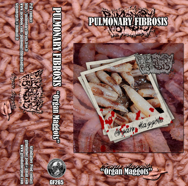 Pulmonary Fibrosis: Organ Maggots cassette