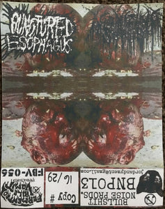 Punctured Esophagus / Agonizing Sepsis: Split 7"
