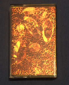 Schistosomiasis: Excretion Of Sporocysts In Parasitic Worm Vomitus cassette