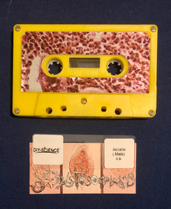 Schistosomiasis: Excretion Of Sporocysts In Parasitic Worm Vomitus cassette