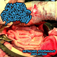 Scrotal Sewage Injection: Detached Esophagus Inflation CDR