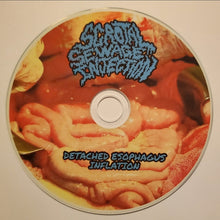 Scrotal Sewage Injection: Detached Esophagus Inflation CDR