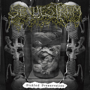 Sequestrum: Pickled Preservation CD