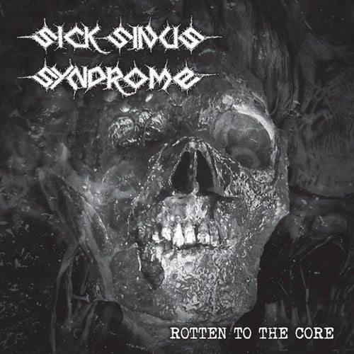 Sick Sinus Syndrome: Rotten To The Core 12