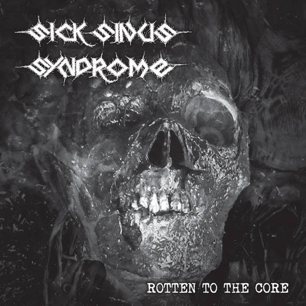 Sick Sinus Syndrome: Rotten To The Core 12