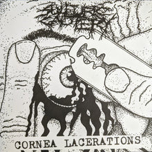 Sulfuric Cautery: Cornea Lacerations 7"