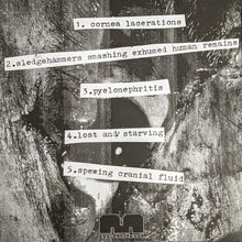 Sulfuric Cautery: Cornea Lacerations 7"